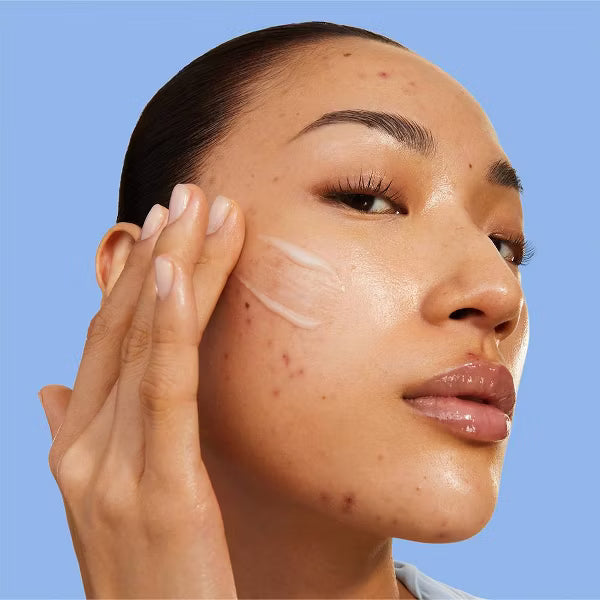 BYOMA Blemish Acne Control Moisturizer - 1.69 fl oz: Paraben-Free, Face Application, Fresh Scent